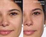 کرم دور چشم آل ابوت آیز کلینیک ۱۵ میل ضد چروک و تیرگی زیر چشم - Image 5